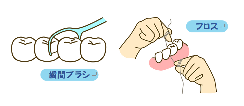 歯間ブラシと